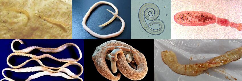 أنواع مختلفة من الطفيليات