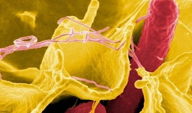 علامات الطفيليات في جسم الإنسان