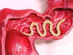 الطفيليات في جسم الإنسان لماذا تظهر