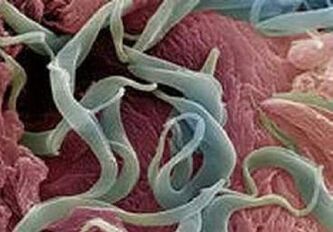 أعراض وعلاج الطفيليات في جسم الإنسان