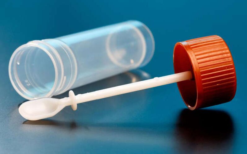 اختبار البراز للديدان