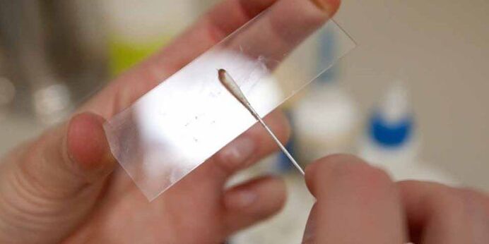 كشط الجلد للطفيليات