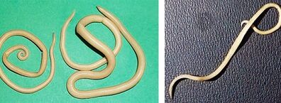 ما هي الطفيليات التي يمكن أن يصاب بها الشخص؟