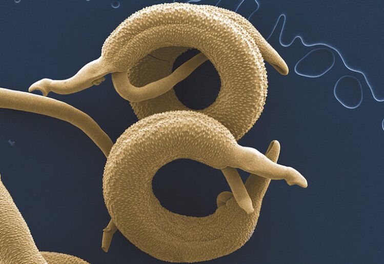 الطفيليات التي تعيش في جسم الإنسان