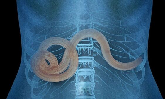 الطفيليات في جسم الإنسان